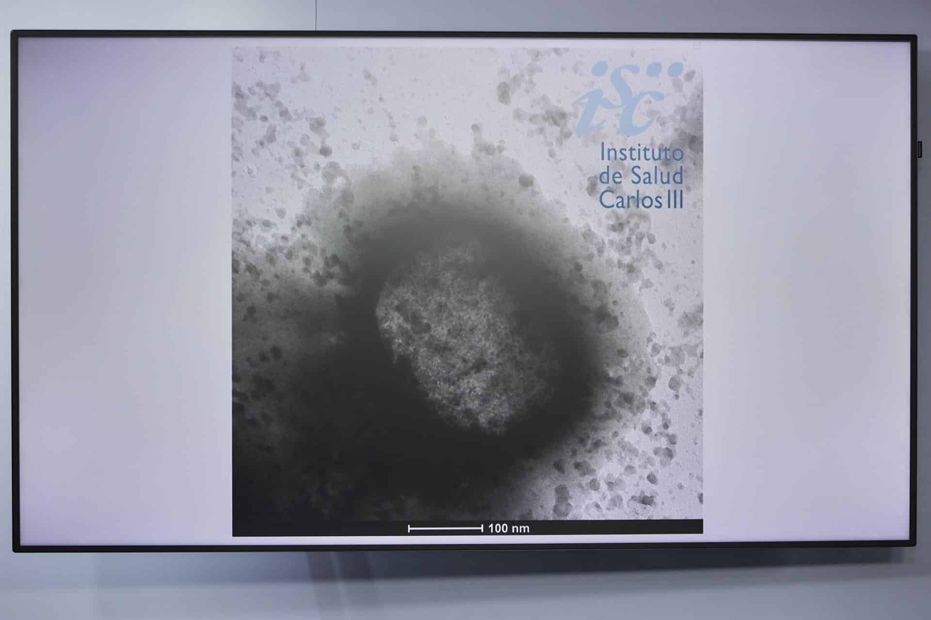 Una molécula de la viruela del mono como resultado de un estudio de la universidad Carlos III . - Jesús Hellín - Europa Press