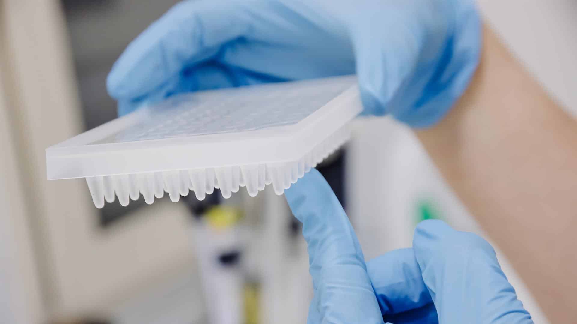 Un técnico de laboratorio preparando una PCR para el análisis de la viruela del mono | EUROPA PRESS