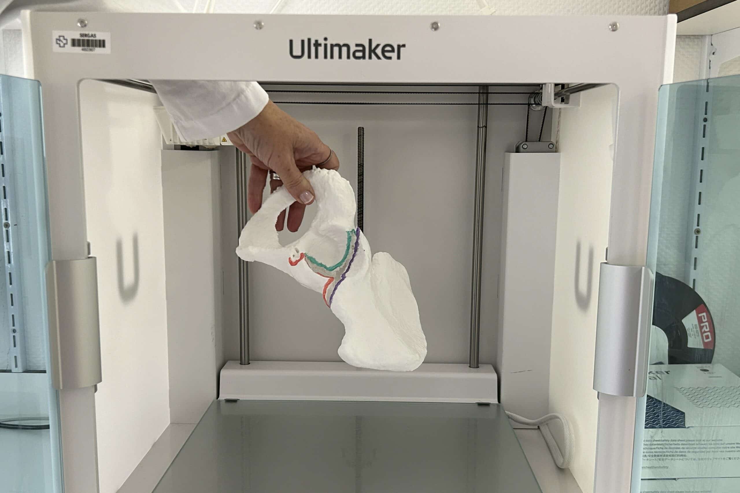 Impresora 3D ubicada en la Unidad de Soporte y Conocimiento del Hospital Arquitecto Marcide